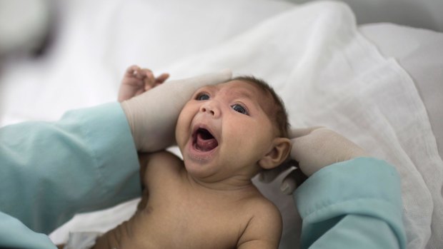 Lara, wh was born with microcephaly in 2016, is examined in hospital at Campina Grande in Paraiba state, Brazil. The country’s impoverished north-east was ground zero for the Zika epidemic.