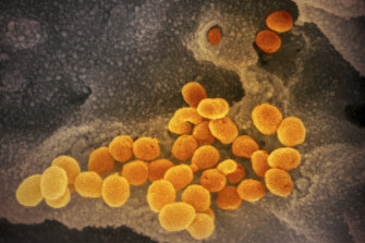 A microscope image shows the Novel Coronavirus SARS-CoV-2, orange, in February 2020 emerging from the surface of cells, gray, cultured in the lab. 