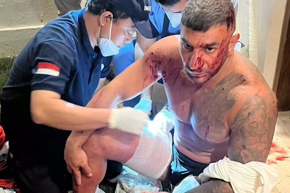 Sanar Ghanim, who was once in a relationship with the stepdaughter of dead underworld figure Carl Williams, after being shot in Bali. He survived his wounds. 
