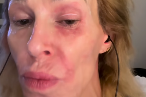 Brandi Glanville health diagnoisis