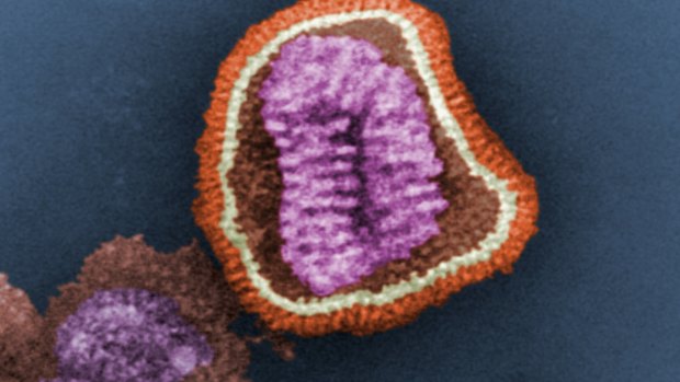 The ultrastructural details of an influenza virus particle.