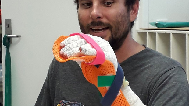 Reptile biologist Mathew Vickers showing his injuries after he was bitten by a grey reef shark off Lizard Island in far north Queensland.