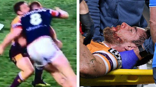 Annesley must look to NFL and ban the 'weaponhead'