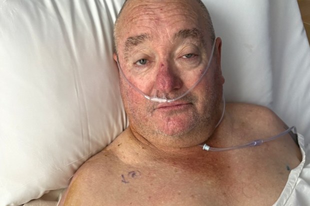 Male breast cancer sufferer Phil Smith.