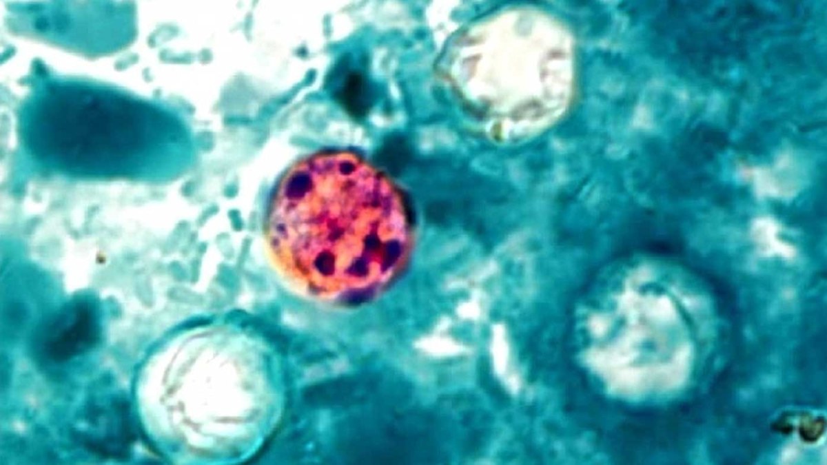 No-one knows why more than a thousand Americans have explosive diarrhoea