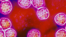 Measles is one of the most contagious diseases.