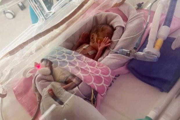 Baby Miracle was born in March at barely 21 weeks, weighing less than a can of Coke.