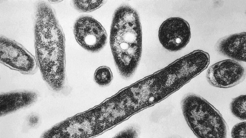 Woman dies as authorities identify suspected source of Legionnaires’ outbreak