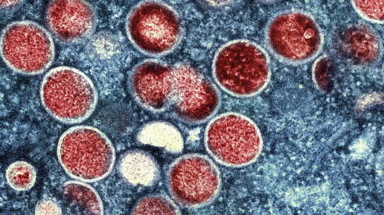 A colourised transmission electron micrograph of mpox particles, which are red.