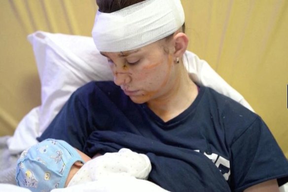 Ukraine woman Olga was seriously wounded after shielding her baby from shrapnel.
