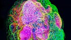 A brain “organoid” – a bundle of lab-grown human tissue. Queensland researchers studied organoids to screen drugs that can flush out damaging senescent cells from brain tissue.