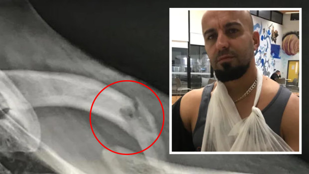 Mustapha Jdid's left collarbone was broken in August last year.