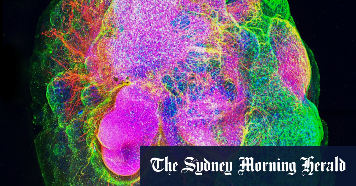 Scientists have found a way to reverse ageing and treat long COVID with 'zombie-hunter' drugs - Vimarsana News