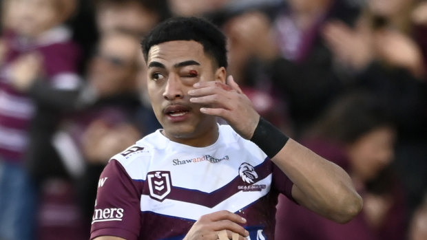 Lehi ‘one eye’ Hopoate battled on with a fractured cheekbone.