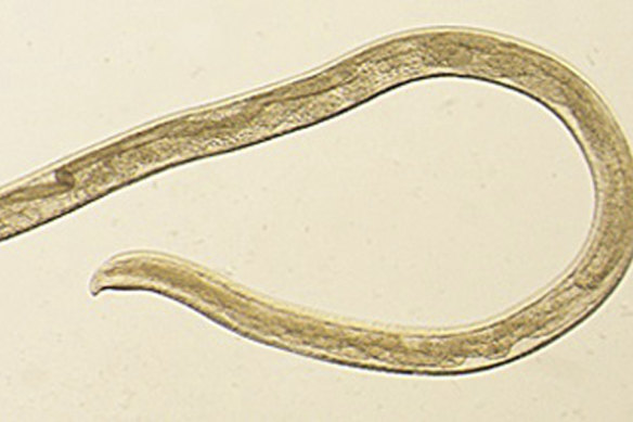Thelazia gulosa is a type of eye worm seen in cattle in the northern United States and southern Canada.