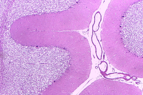 A stained section of human cerebellum, from the Victorian Brain Bank.