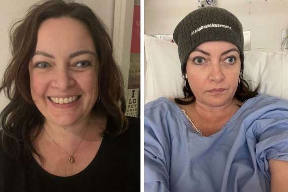 Alicia Newnham, 44, before and after her battles with long COVID.