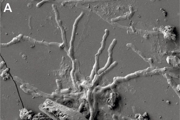 Nerve cells preserved within the organic glass.
