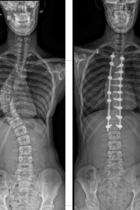 Scarlett’s scans, before and after.