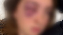 Sam was the victim of a horrific attack on a bus in NSW.