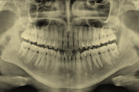 ‘A prevailing fixation’: Why do we love straight, white teeth?