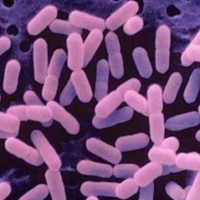 Listeria infection is rare but the bacteria can be fatal.