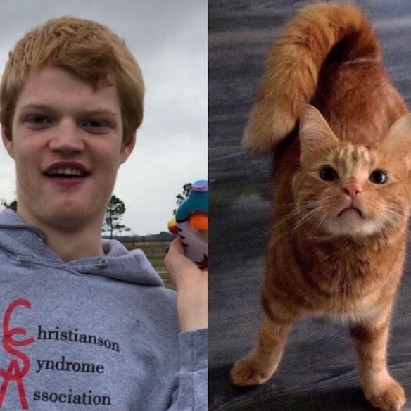 “We also chuckle at the fact that they are both gingers,” comments Debbie Nash of her emailed photos of Phineas next to her son Andrew, who has Christianson syndrome.