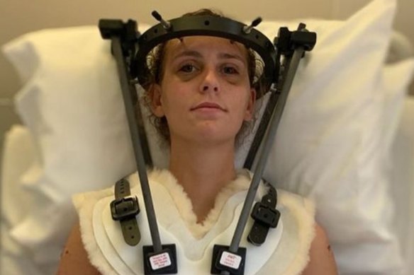 Rylee Foster had to wear a halo-fixation device after a horrific car crash.