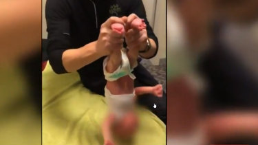 A disturbing Facebook video of a Melbourne chiropractor performing a controversial treatment on an infant resulted in him being referred to regulators as medical groups denounce the practice.