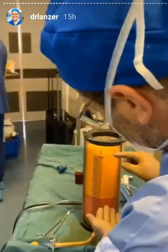 Social media video of Dr Daniel Lanzer and colleagues counting up litres of fat removed in a liposuction procedure. 