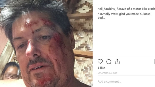 Neil Hawkins was injured in a motorcycle accident. 
