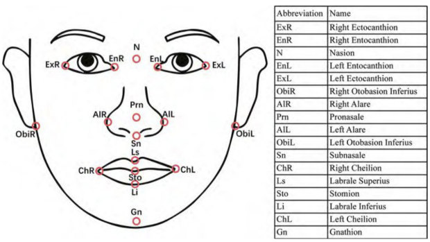 An example of how gene variants influence facial morphology in a Eurasian population.