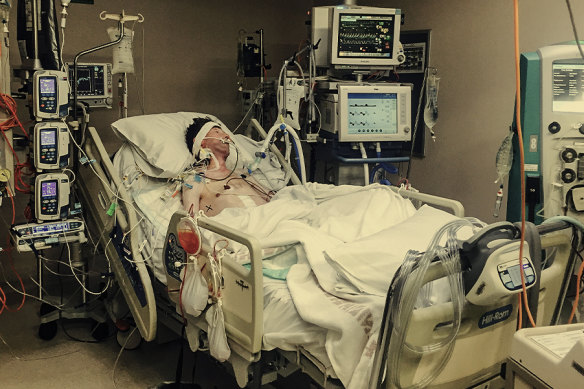 Tim Boyle in an induced coma in the Austin Hospital in 2015 after he received a bowel and kidney transplant.