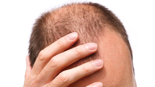 Hair loss treatment company Ashley & Martin has been found to have unfairly locked customers into contracts. 