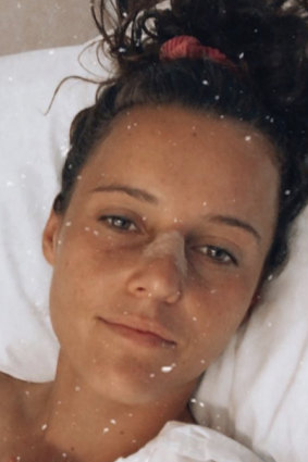 Matildas star Hayley Raso had surgery on Wednesday to repair her nose, which she broke in two places against China last week.