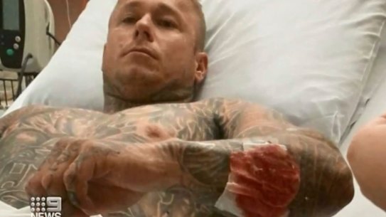 Ricky Chapman in hospital following the shooting at Perth Motorplex. 