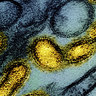 Colorised image showing avian influenza A H5N1 virus particles (yellow), grown in Madin-Darby Canine Kidney (MDCK) epithelial cells (blue).