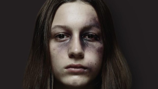 Images of bruised and battered school students will appear around Perth to raise awareness of the negative impact sharing and liking violent footage has on young people. 
