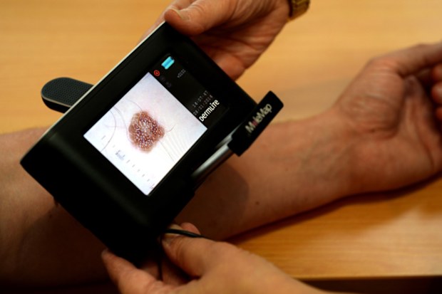 A patient has their skin checked for melanoma. (AAP stock)