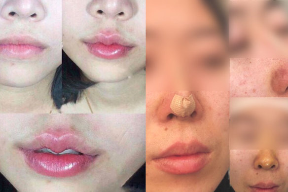 Images of cosmetic procedures posted to Lee Kim Tan's Facebook page.  