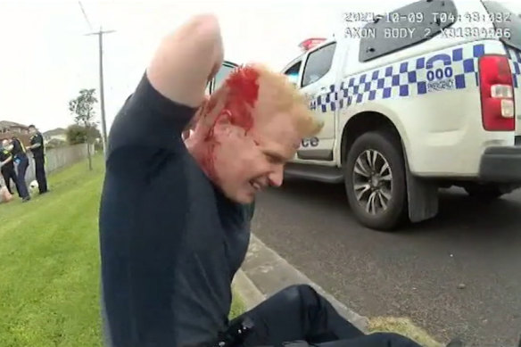 Senior Constable Rowan Baldam after the attack.