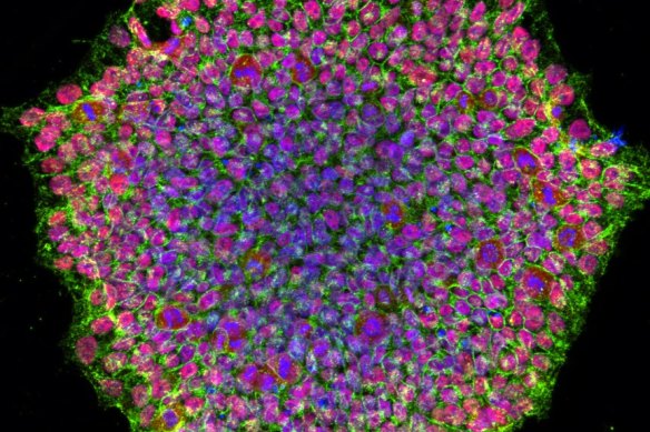 A colony of human pluripotent stem cells.