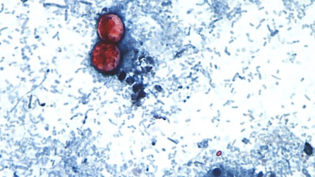Cyclospora cayetanensis oocysts as seen through a microscope.