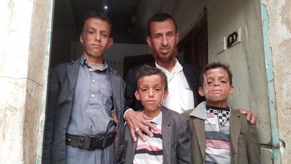 From left, Omar, 12, with his father Mohammed and brothers Ahmed, 10, and Abdul, 9, bear the scars of war. 