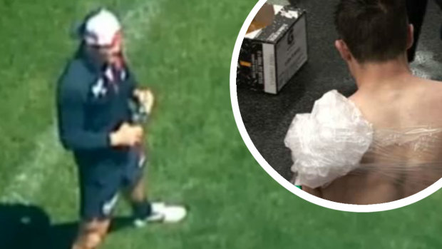 Sideline eye: Cooper Cronk watching the Roosters' captain's run. Inset: Icing his shoulder.