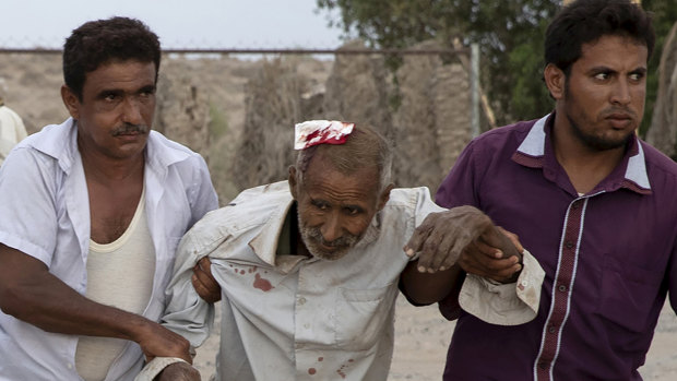 An injured civilian is brought to a field hospital in Yemen's Al Durayhimi district. 