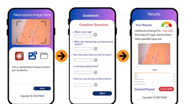 Using AI, this app may tell if you have an STI
