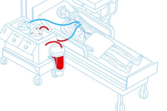 A depiction of the process from the website of the KrioRus cryogenics firm in Moscow.
