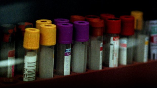 Testing for STIs is at an all-time high among gay and bisexual men.

