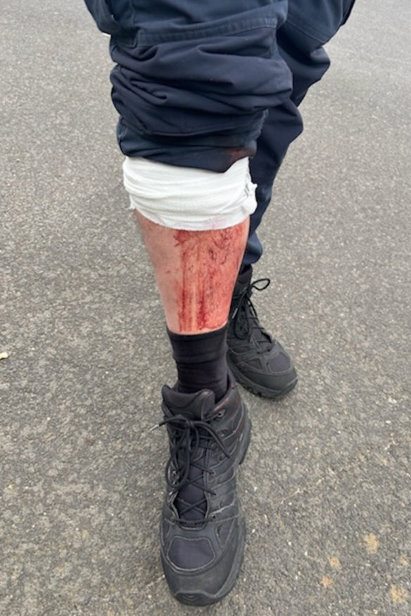 A male senior constable aged in his 30s from Corio received a serious laceration to his leg while policing the protests on Sunday, police said.